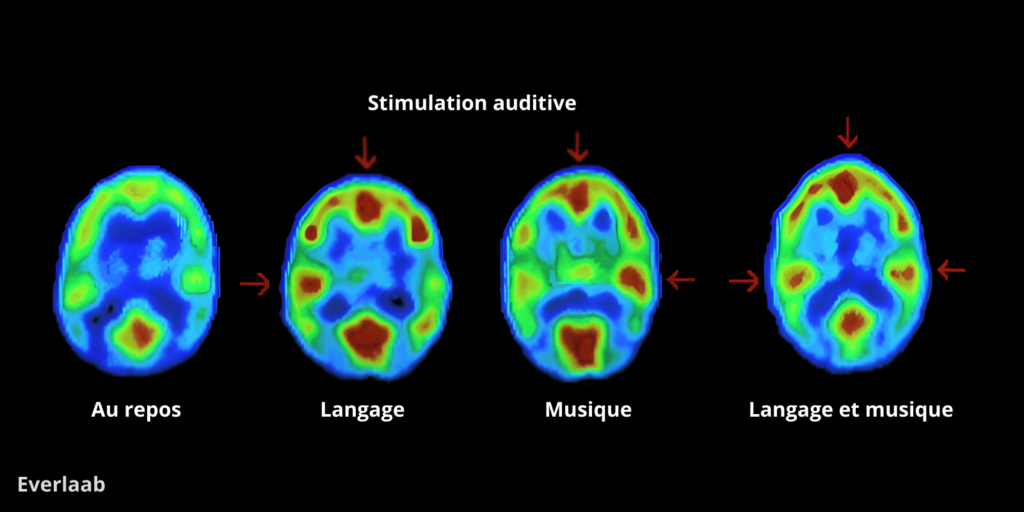 effet-de-la-musique-sur-le-cerveau
